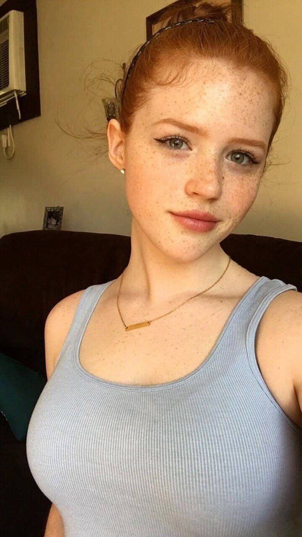 Beautiful freckles
