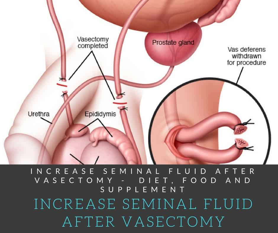 V-Mort reccomend Having an orgasm after a vasectomy
