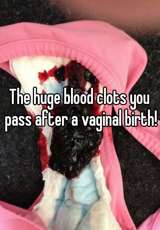 Blood clots coming out of vagina