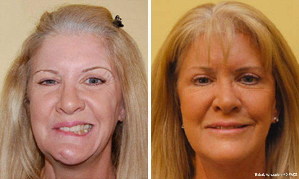 best of Facial for trauma surgery Reconstructive