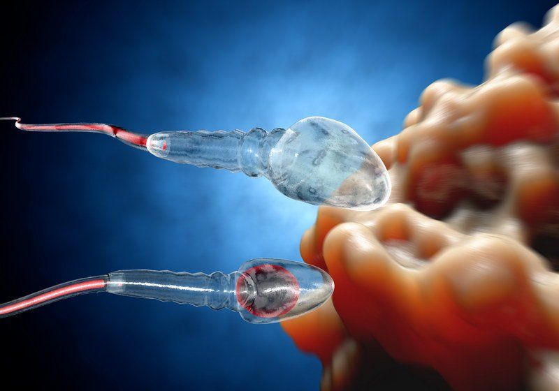 best of Microsurgical Aspiration sperm epididymal