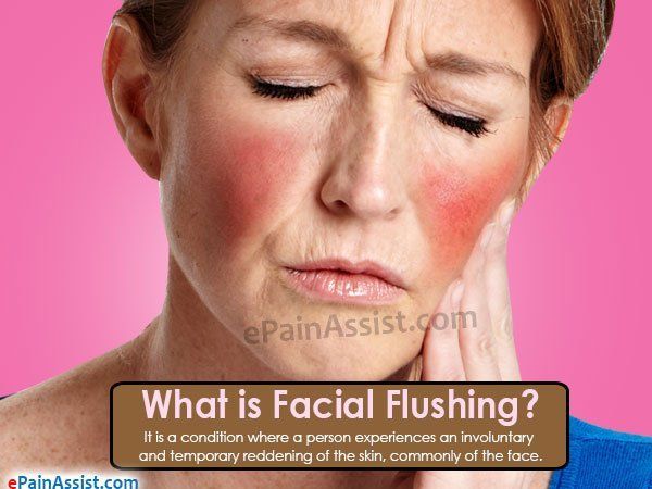 best of Flushing treatment Facial
