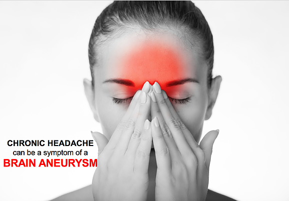 Speed reccomend Headache aneurism facial pain