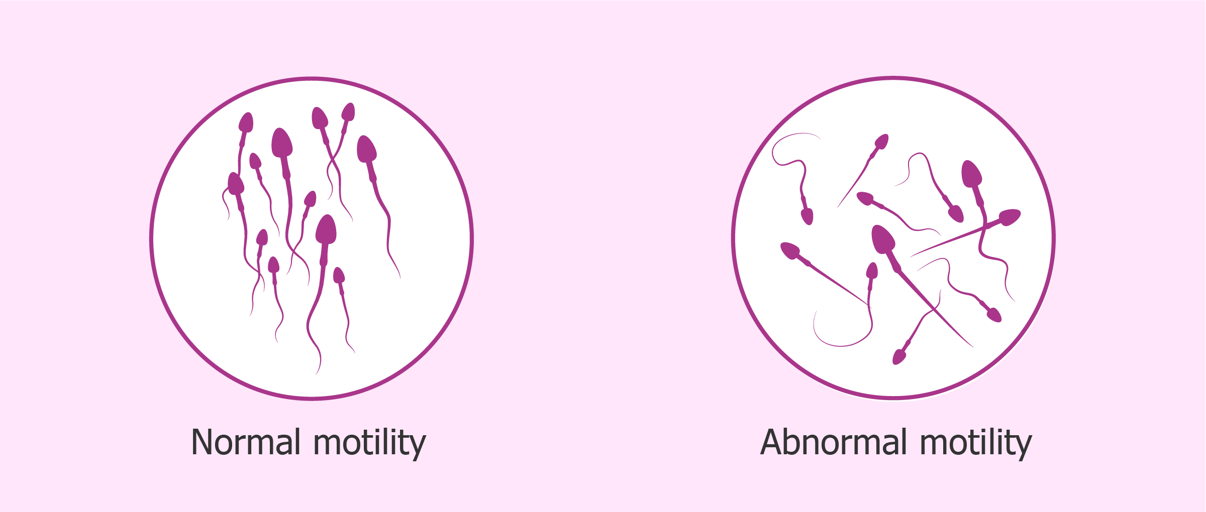 best of Motility sperm low Cause