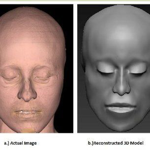 Tart reccomend Facial reconstruction set