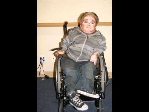 Snapple reccomend Erick the midget and his girlfriend