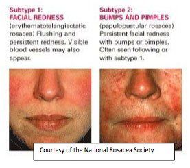 Severe facial skin care
