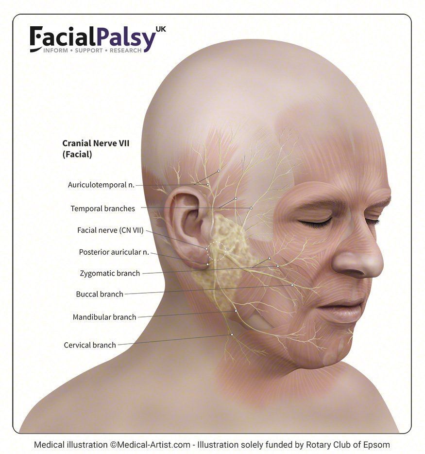Stormy W. reccomend Brain surgery facial nerves