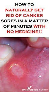best of Sores Asian canker