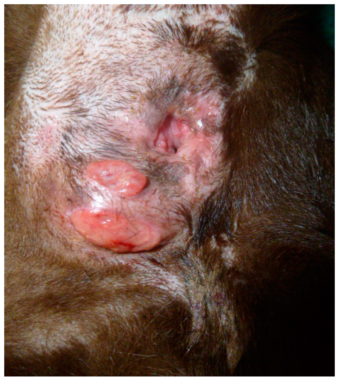 The K. reccomend Squamous cell carcinoma of the anus