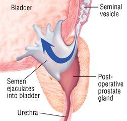 Prostate Ekstazes Sperm Orgasm