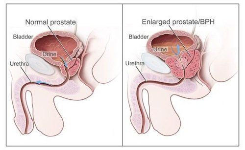 Prostate Ekstazes Sperm Orgasm