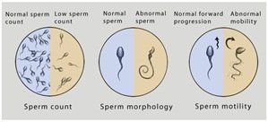 Post vasectomy sperm counts