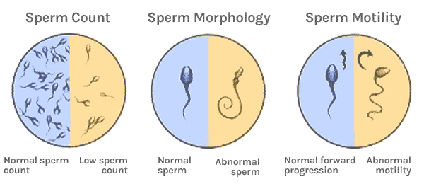 Slight abnormality in sperm