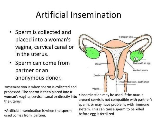 Apple reccomend Woman getting sperm by many men