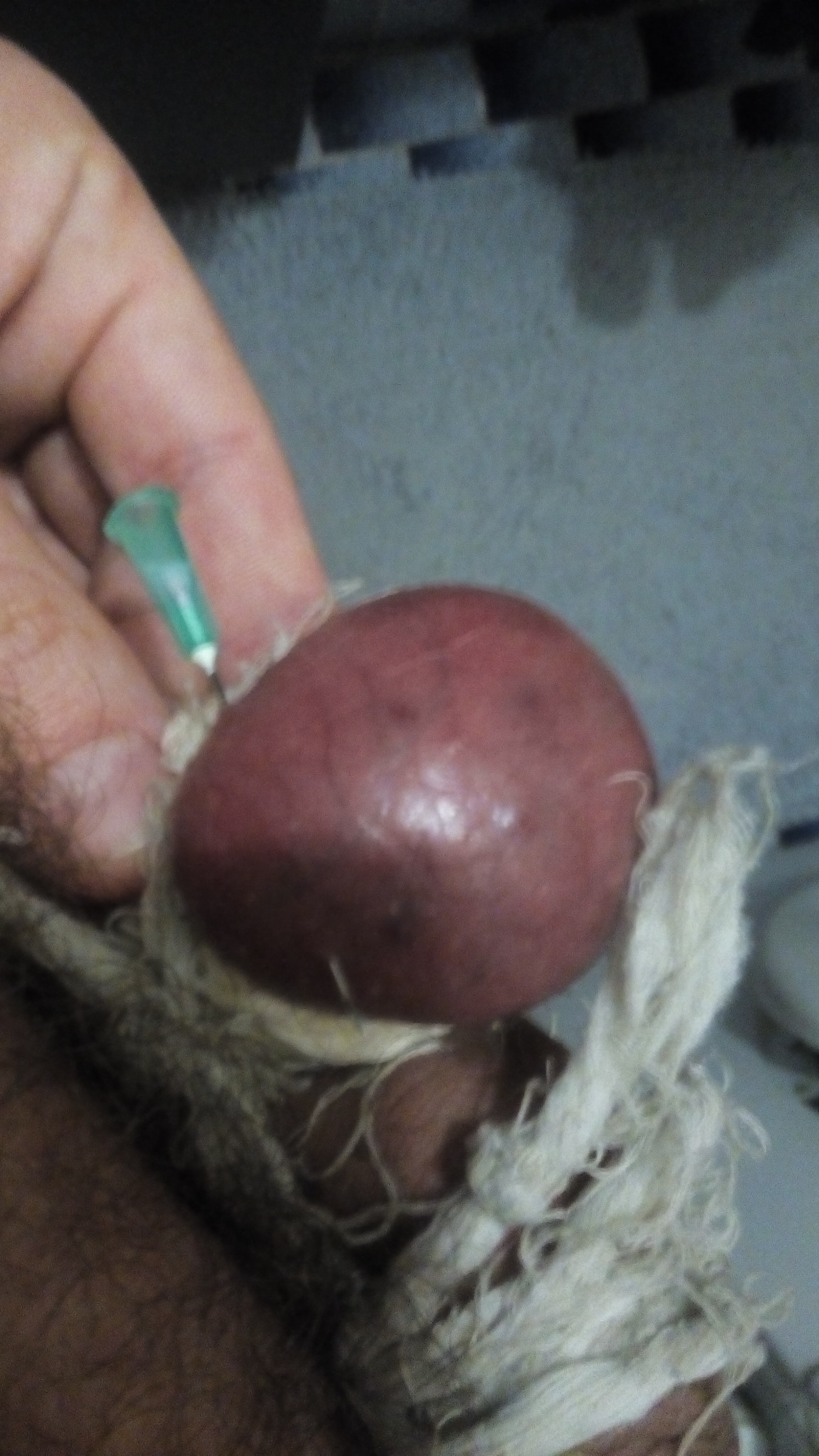Testicle needle torture different size