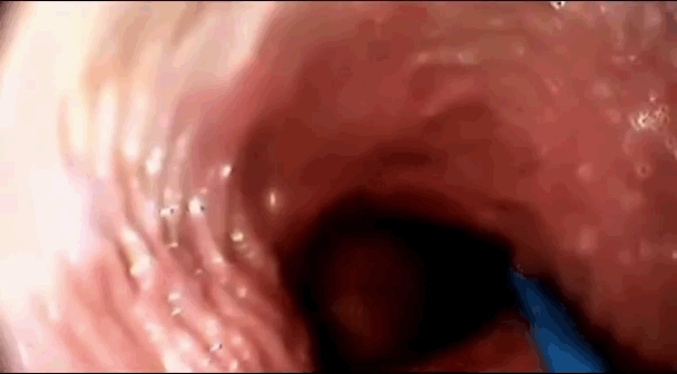 best of View vagina inside