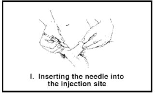 Injecting very large dose
