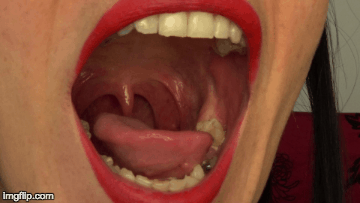 best of Uvula wide tongue