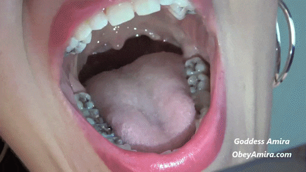 Han S. reccomend wide tongue uvula